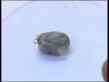 Paralysis Tick